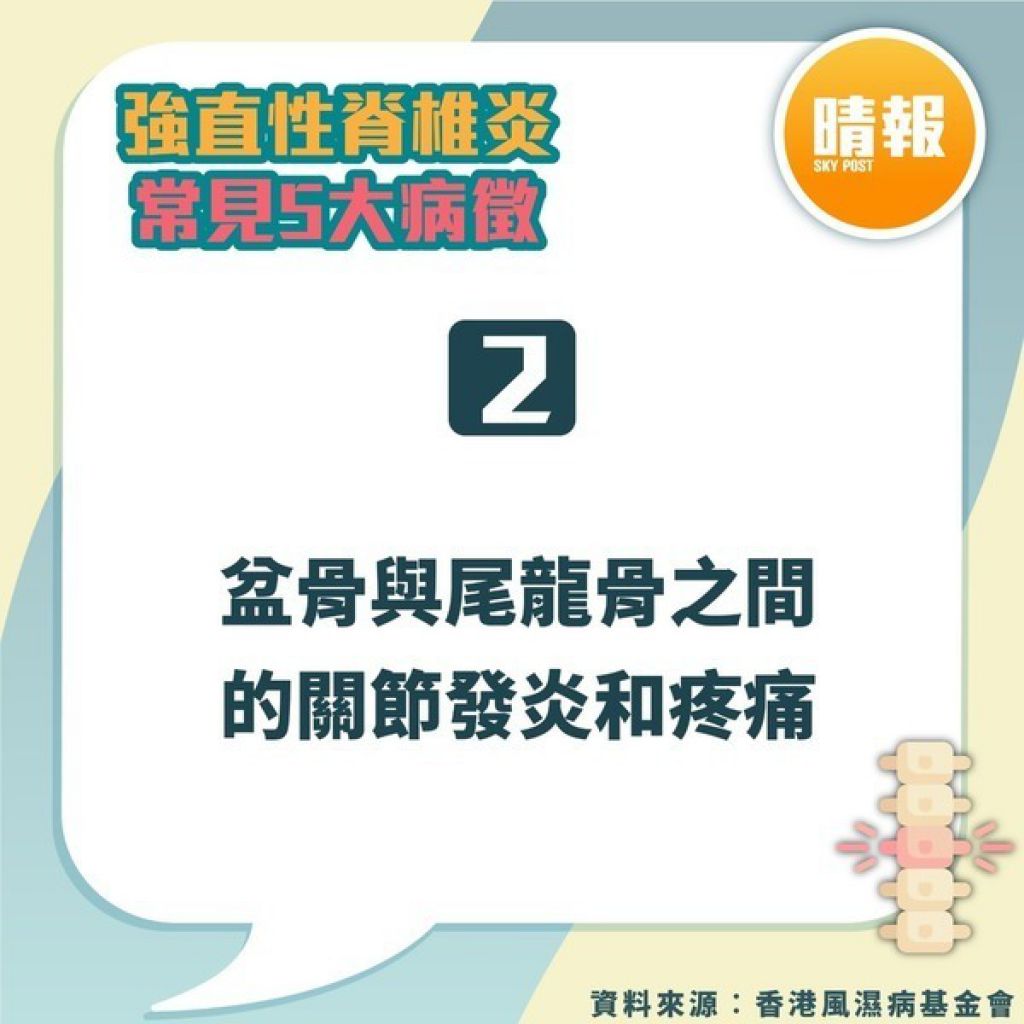 强直性脊椎炎｜驼背父下背痛20年以为操劳过度 儿子同样症状揭患强直性脊椎炎｜附5大常见病徵