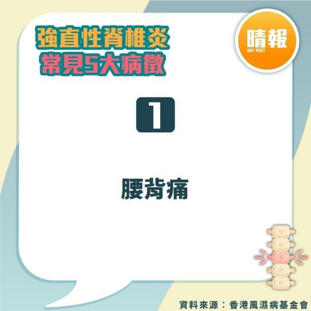 强直性脊椎炎｜驼背父下背痛20年以为操劳过度 儿子同样症状揭患强直性脊椎炎｜附5大常见病徵