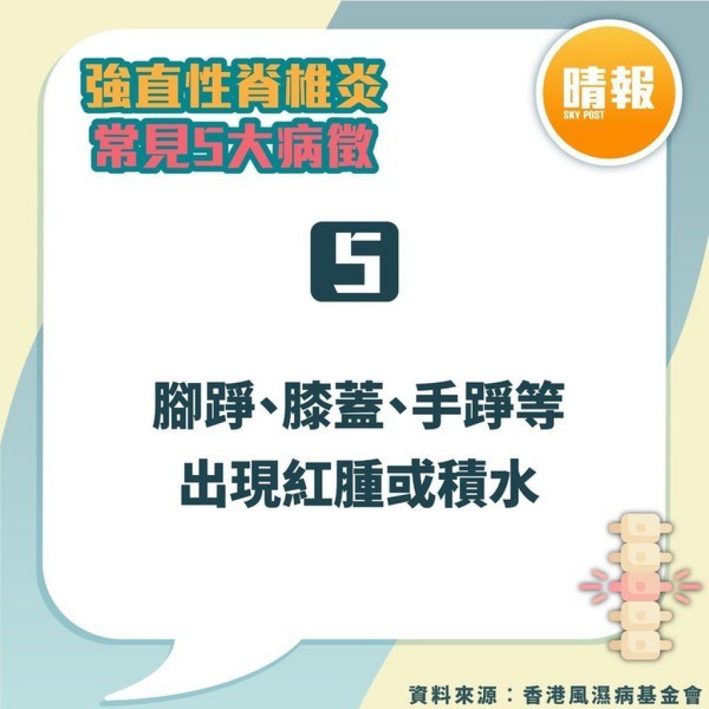 强直性脊椎炎｜驼背父下背痛20年以为操劳过度 儿子同样症状揭患强直性脊椎炎｜附5大常见病徵