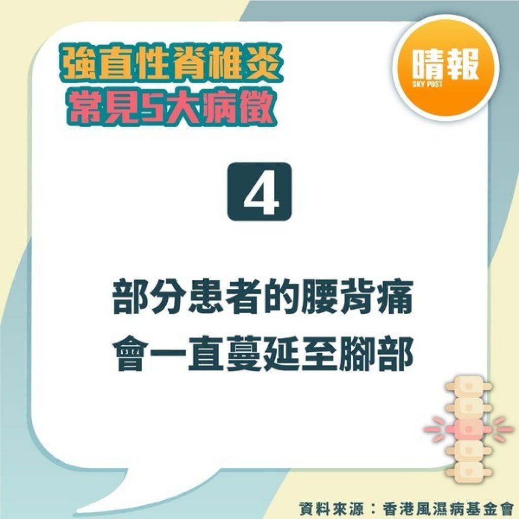 强直性脊椎炎｜驼背父下背痛20年以为操劳过度 儿子同样症状揭患强直性脊椎炎｜附5大常见病徵